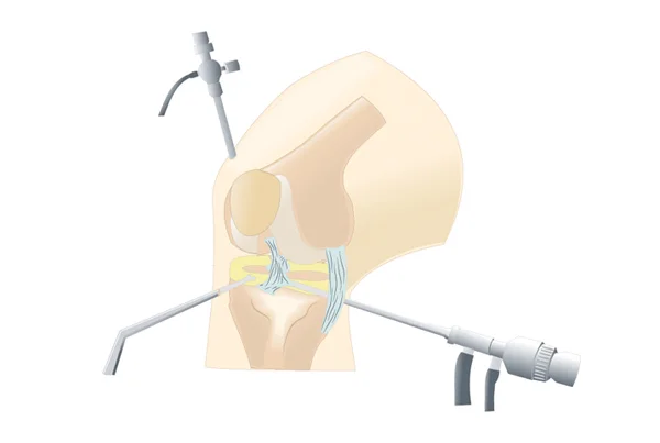 Joint Preservation Surgery