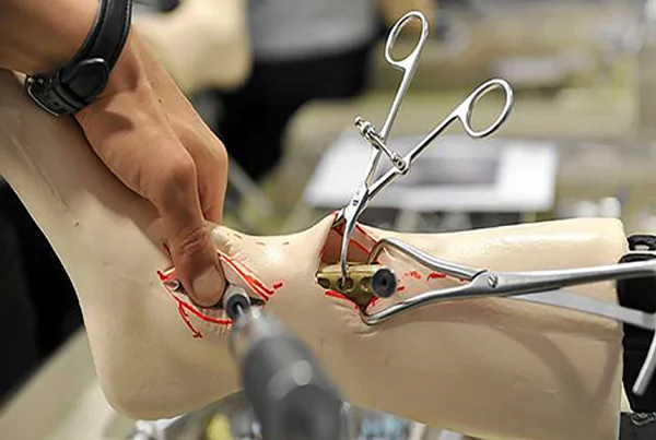 Foot and Ankle Surgery