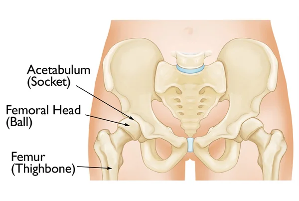 Pelvi-Acetabular Surgeries