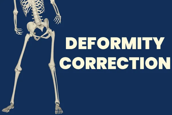 Deformity Correction